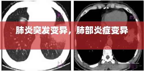 肺炎突发变异，肺部炎症变异 